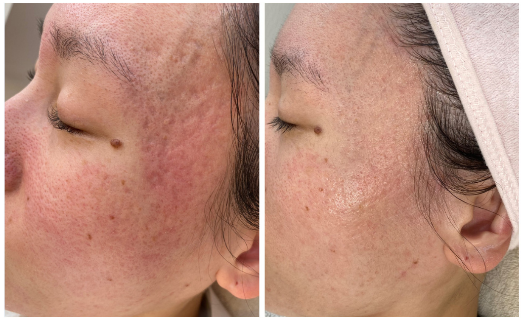 ビフォーアフター2