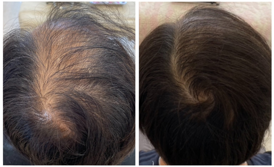 ビフォーアフター2