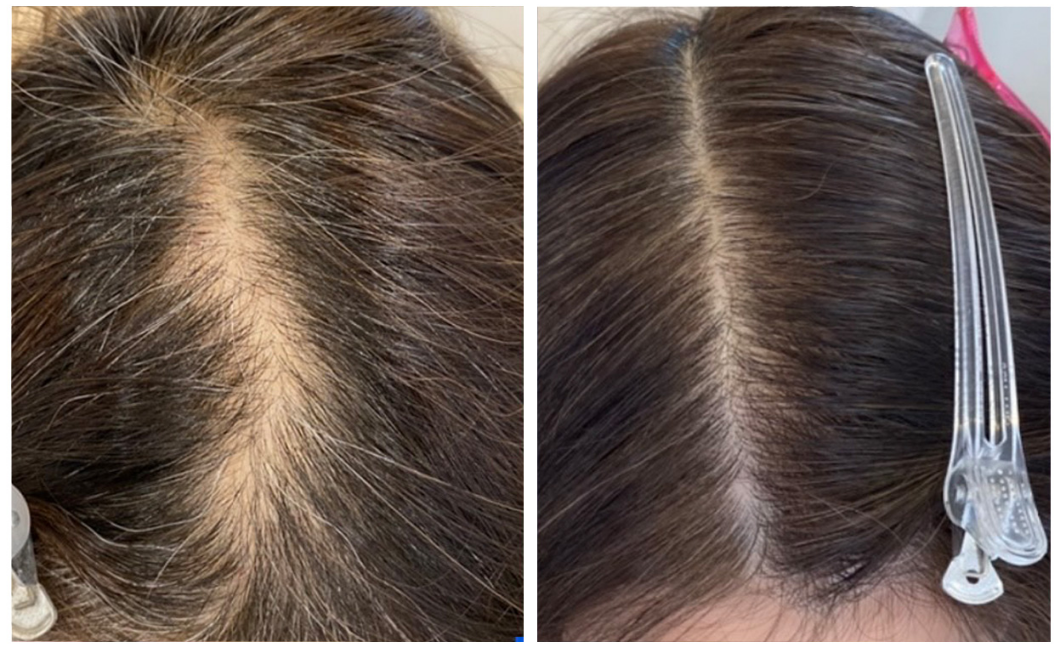 ビフォーアフター3